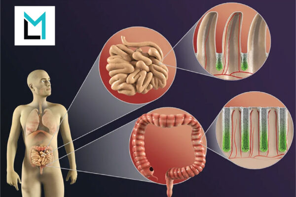 Medical illustrations and animations